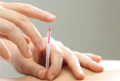 【募集】大うつ病性障害に対する鍼治療の共同研究を行っています